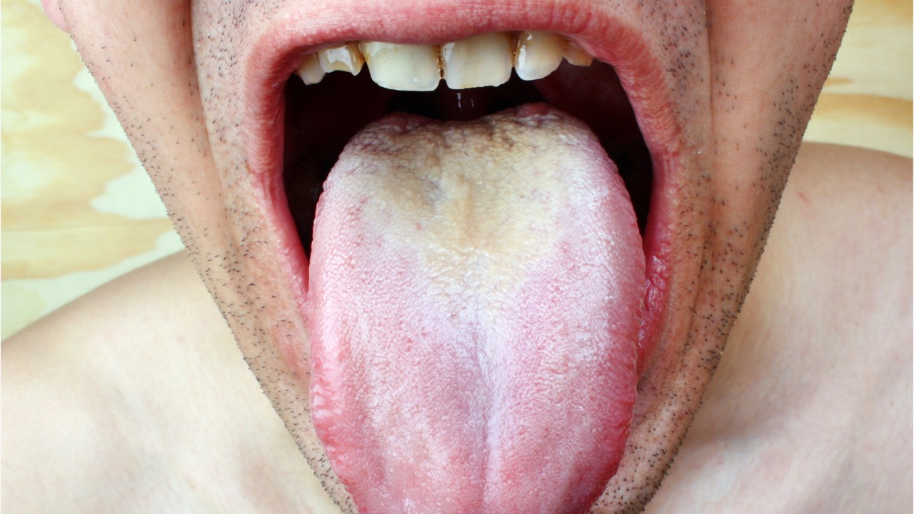 picture of hairy tongue Gay big dick